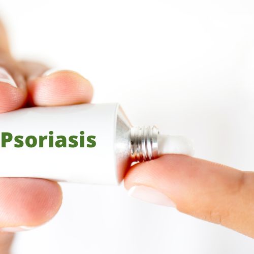 Pommade psoriasis, crème, tube