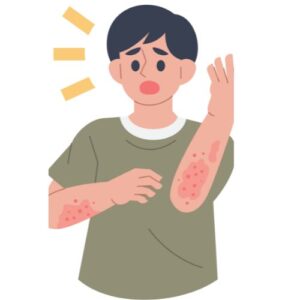 eczéma allergique démengeaisons bras 