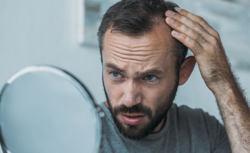 Psoriasis et perte de cheveux, causes, symptômes traitements