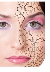 Psoriasis sécheresse cutanée