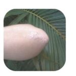 coude psoriasis squames