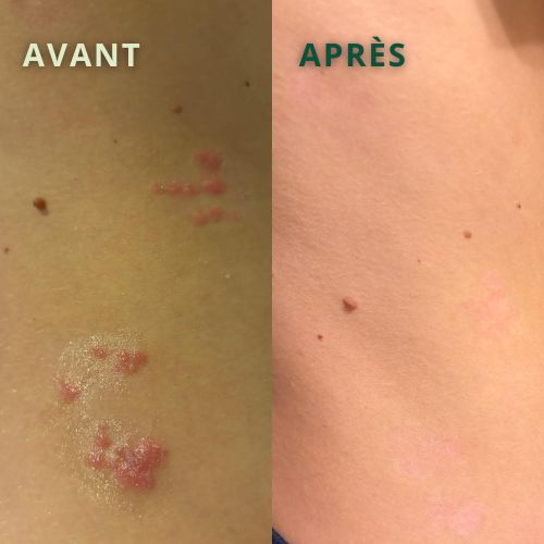 avant-après-cote-constanza