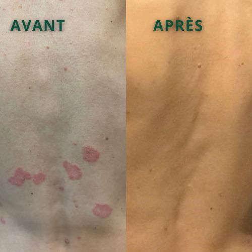Avant-apres-dos-constanza