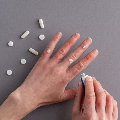 eczema traitements sans ordonnance