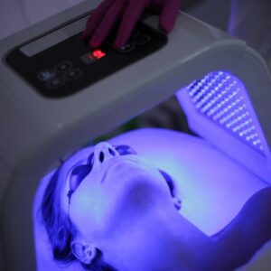 therapie par lumière bleue acné rétentionnelle