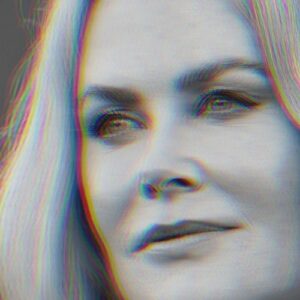 nicole kidman et eczéma