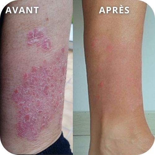 elodie-avant-apres (1)