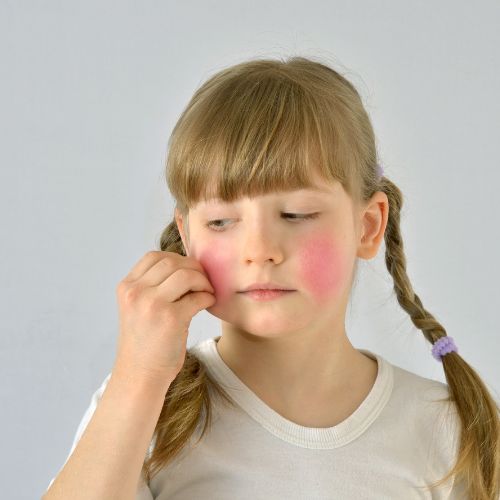 eczema covid étude vaccin enfants bienfait