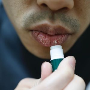 baume reparateur hydratant lèvres sèches