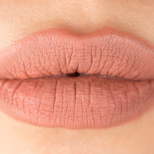 eczema lèvres causes symptômes traitements